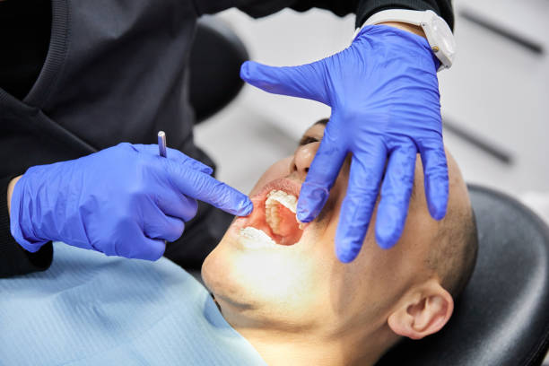Emergency Dental Filling Replacement in NY